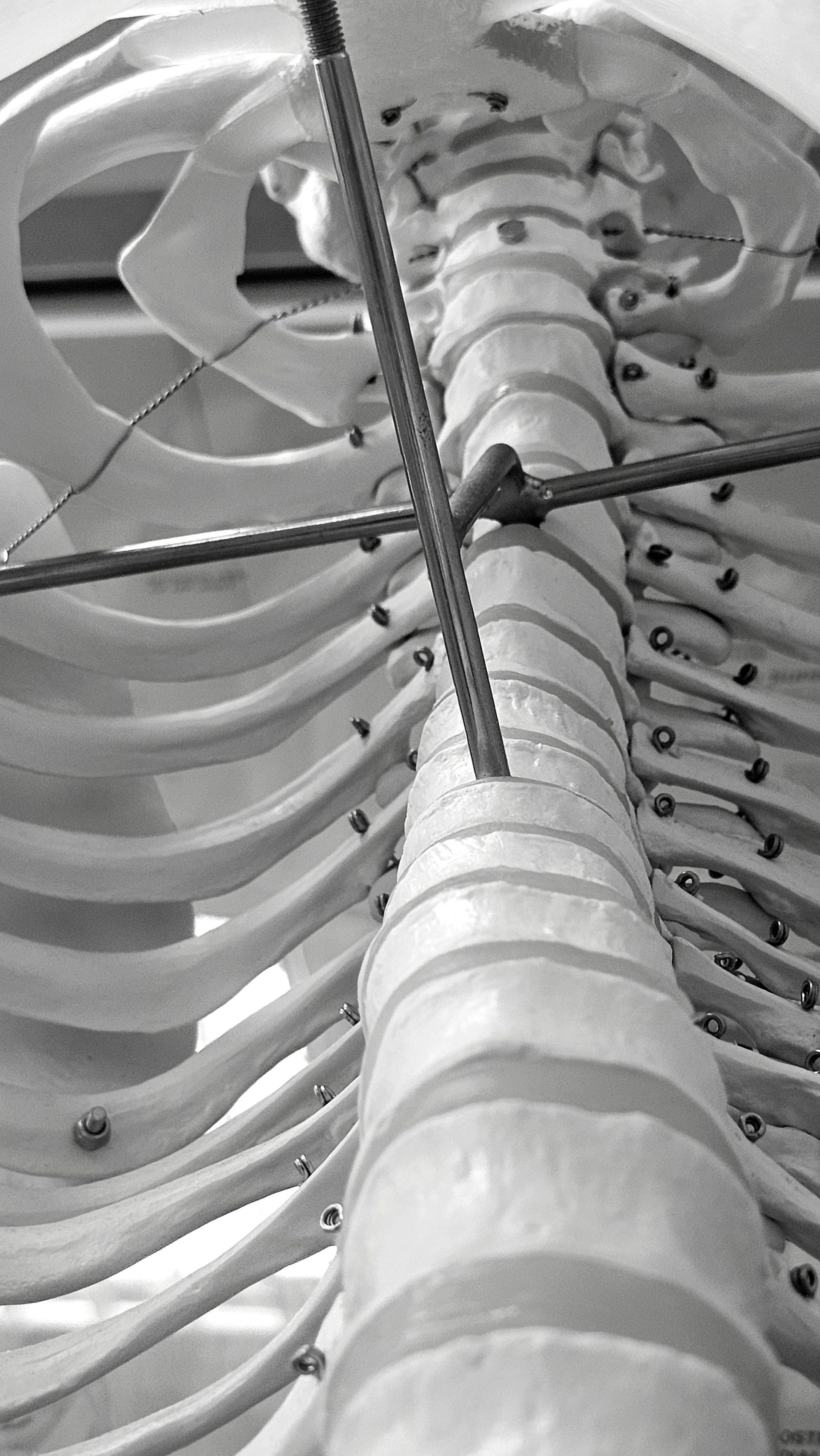 Intricate black and white photo of a human rib cage model with metal rods and wires