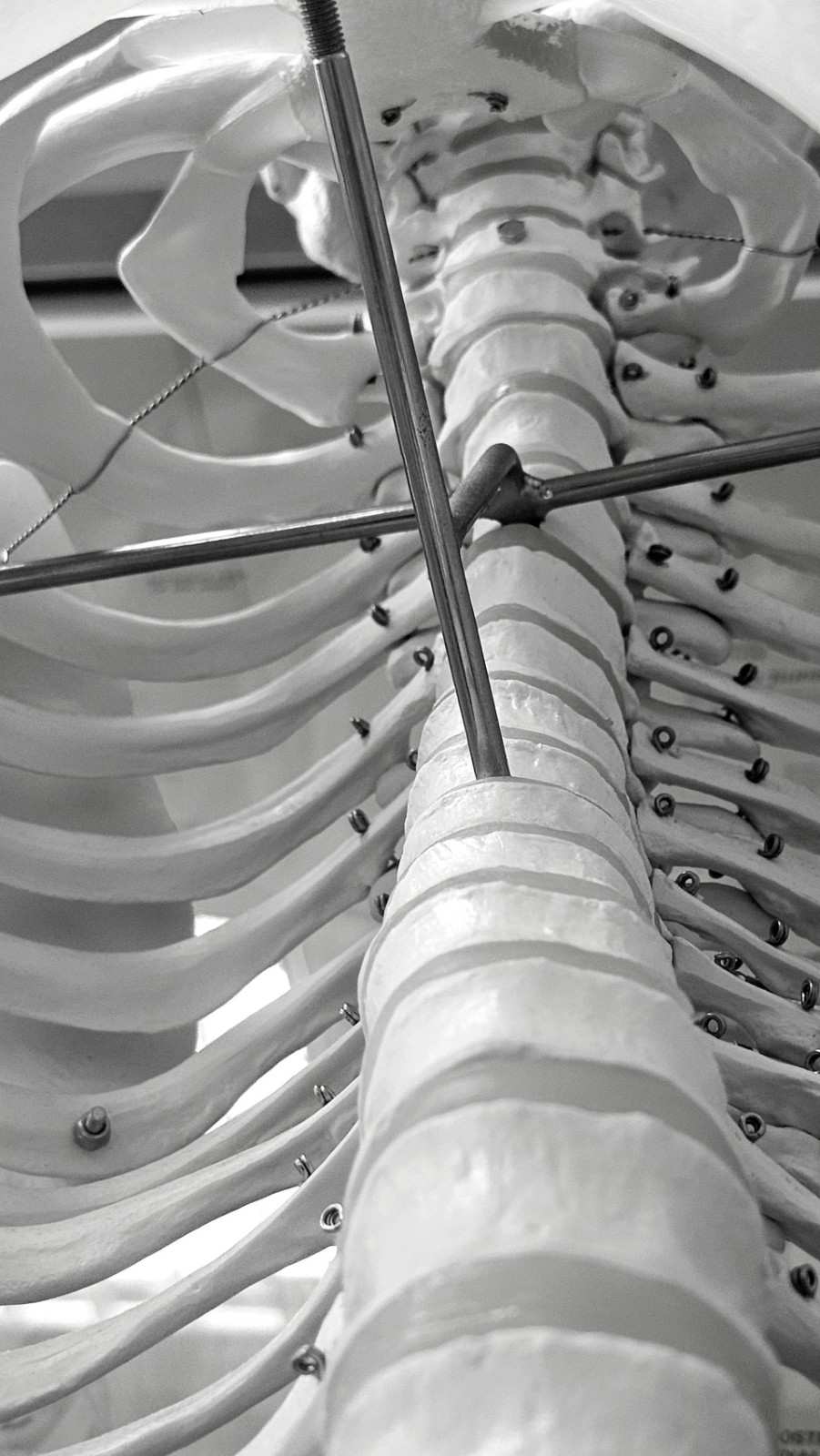 Intricate black and white photo of a human rib cage model with metal rods and wires